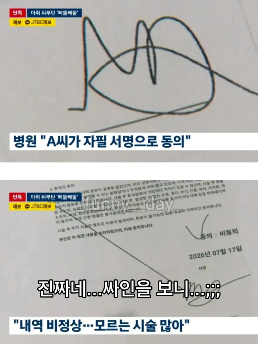 마취 덜 깬 사이 피부과에서 1시간40분만에 900만원 뜯긴 환자.jpg - 이미지 3