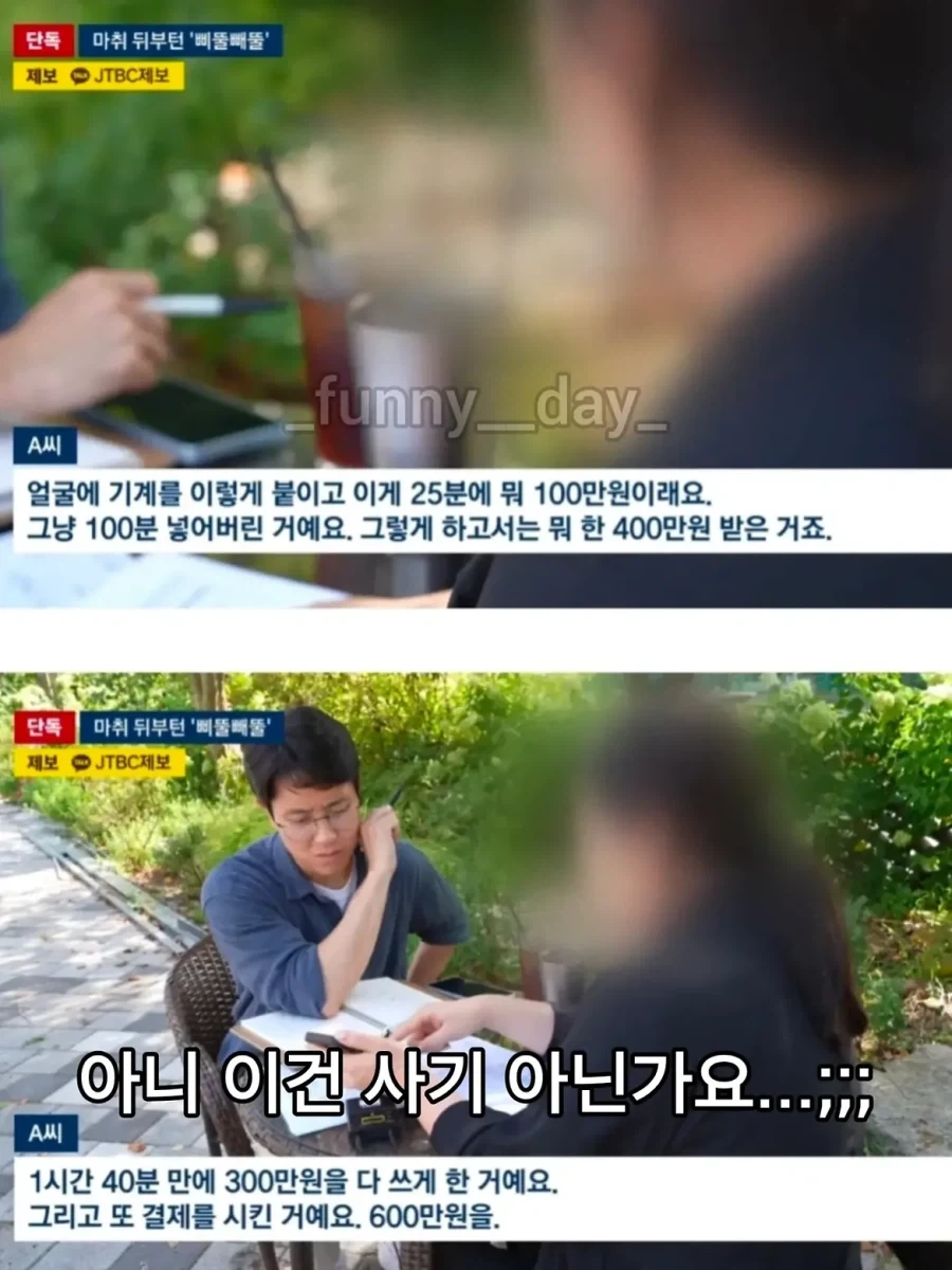마취 덜 깬 사이 피부과에서 1시간40분만에 900만원 뜯긴 환자.jpg - 이미지 4