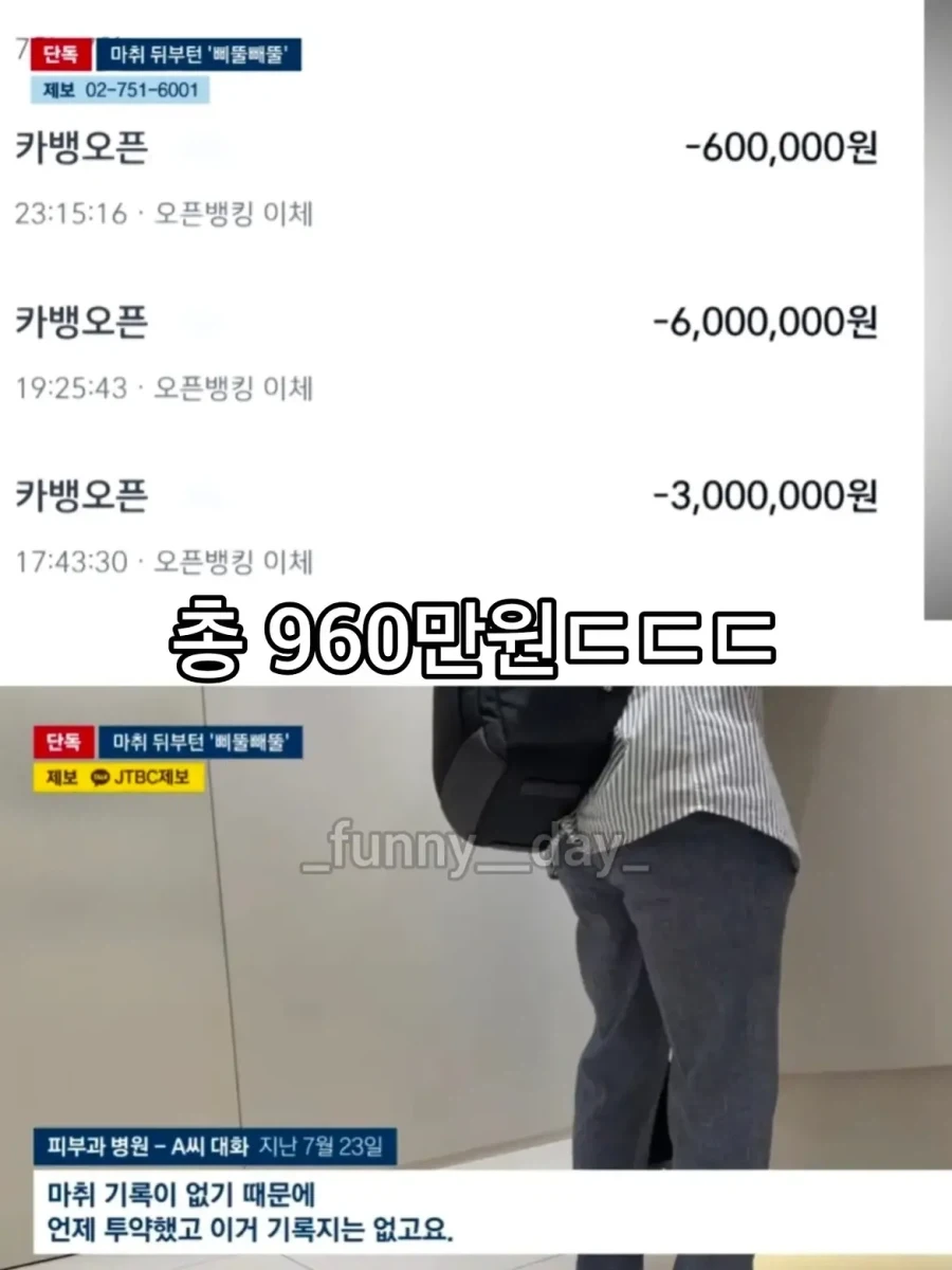 마취 덜 깬 사이 피부과에서 1시간40분만에 900만원 뜯긴 환자.jpg - 이미지 5