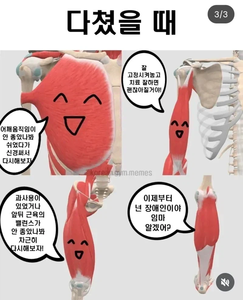 운동에 비협조적인 근육 - 이미지 3