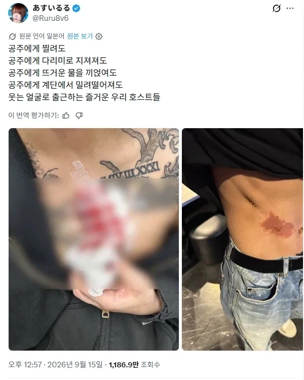 호스트 하다 손님한테 공격당했던 이유 모음