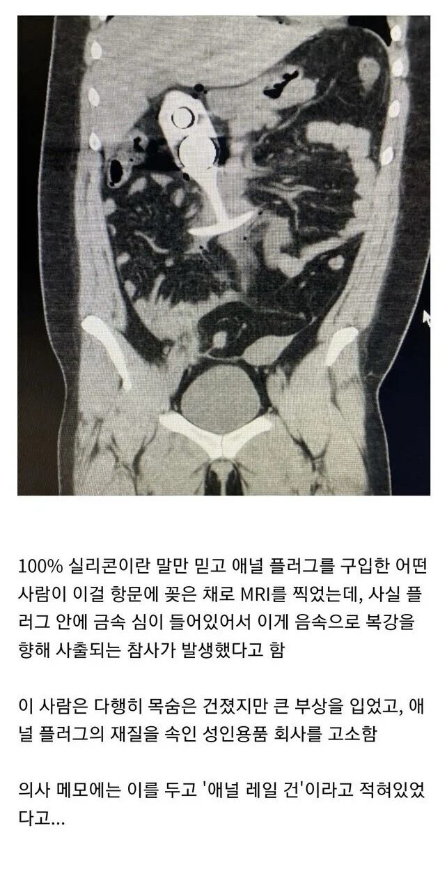 100% 안전하다는 말도 한번은 의심해봐야하는 이유