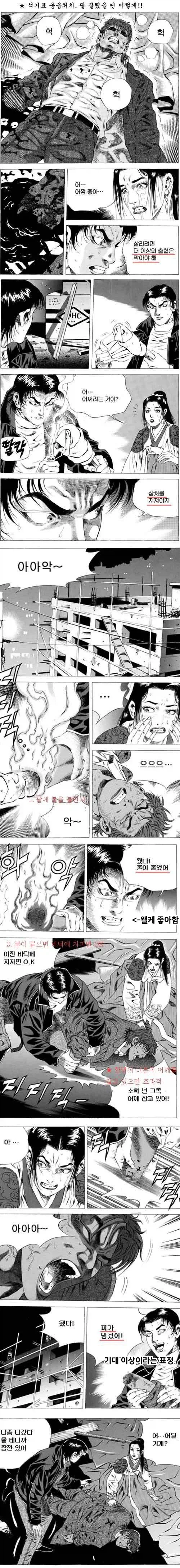 출혈을 치료하는 만화