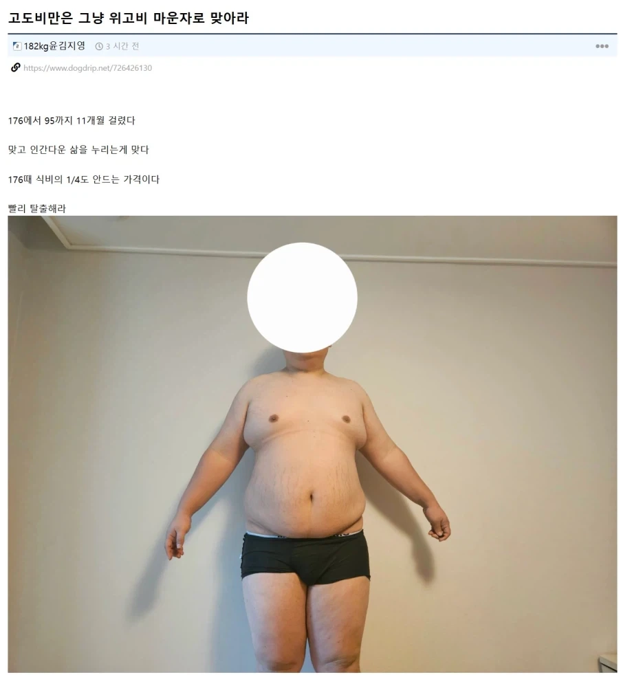 마운자로로 176KG에서 95KG까지 뺐다는 사람... ㄷㄷ;;;