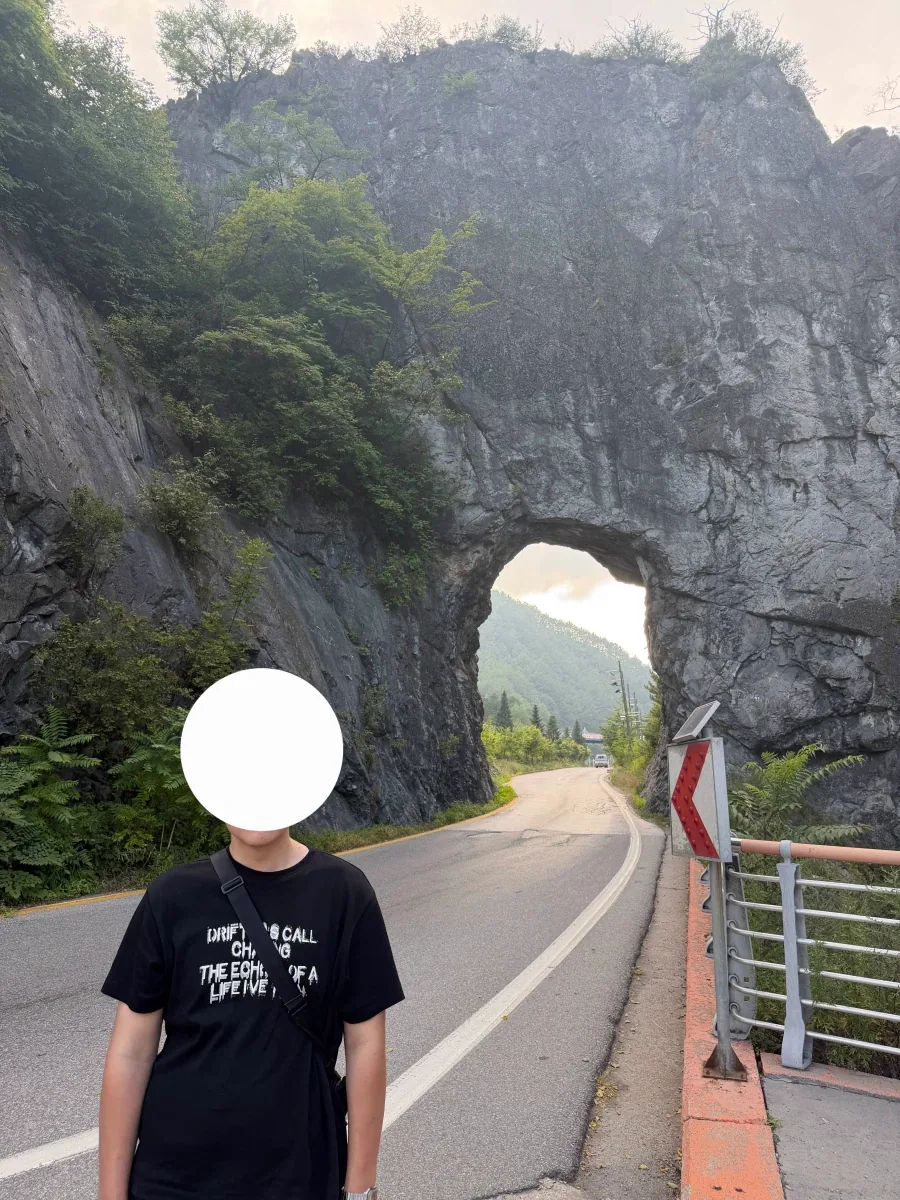 마운자로로 176KG에서 95KG까지 뺐다는 사람... ㄷㄷ;;; - 이미지 2