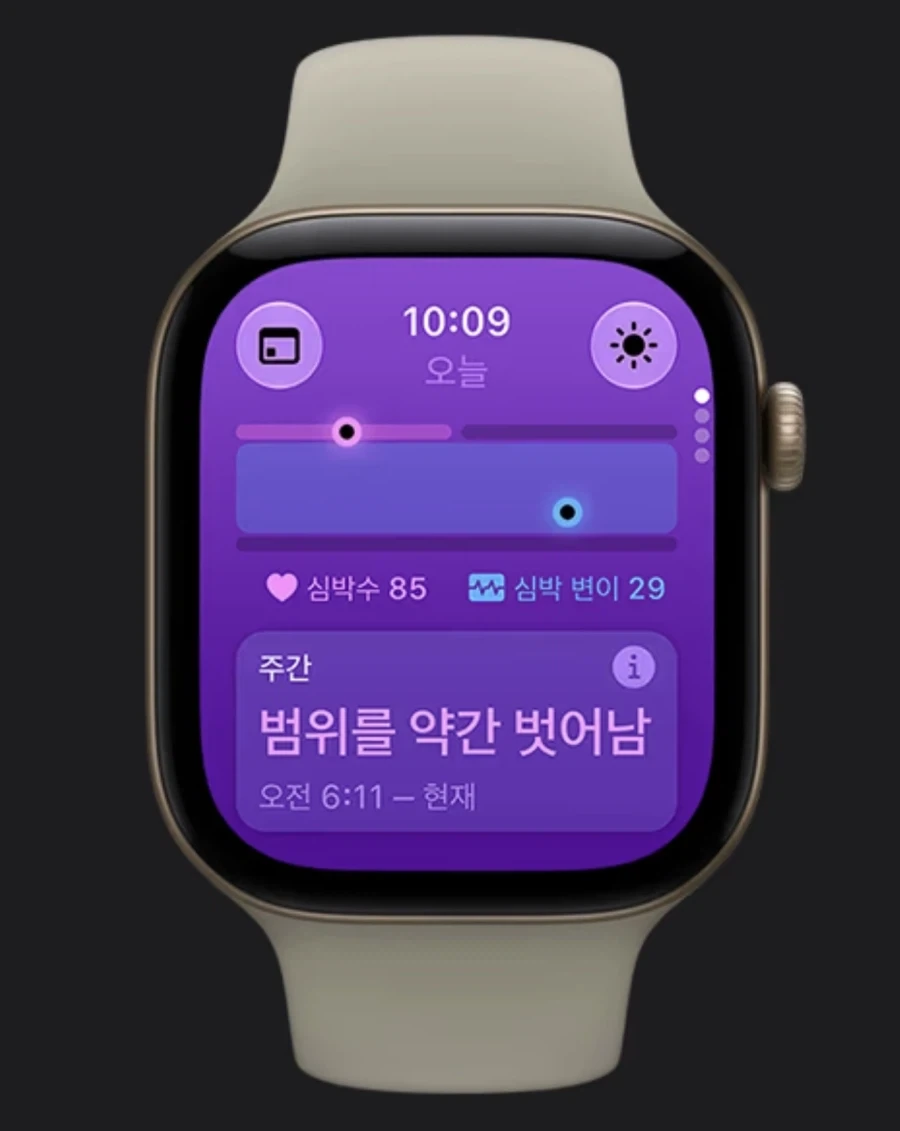 애플워치 베젤은 점점 늘어나는 군 - 이미지 4
