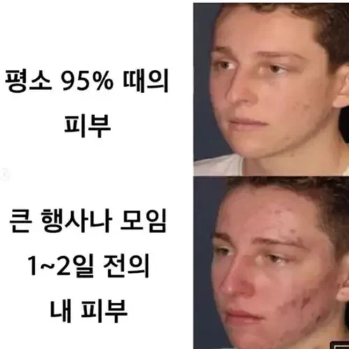 약속날 피부상태 공감