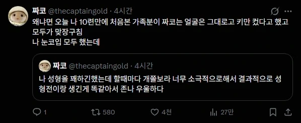 성형 했는데 의미가 없음