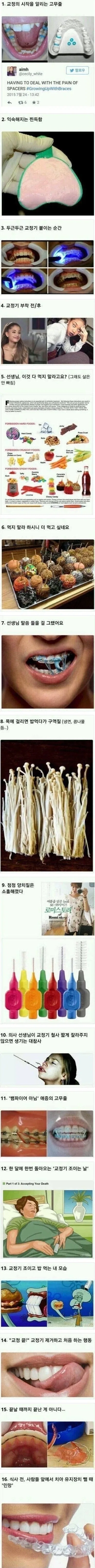 치아 교정하는 사람이 겪는 일.jpg