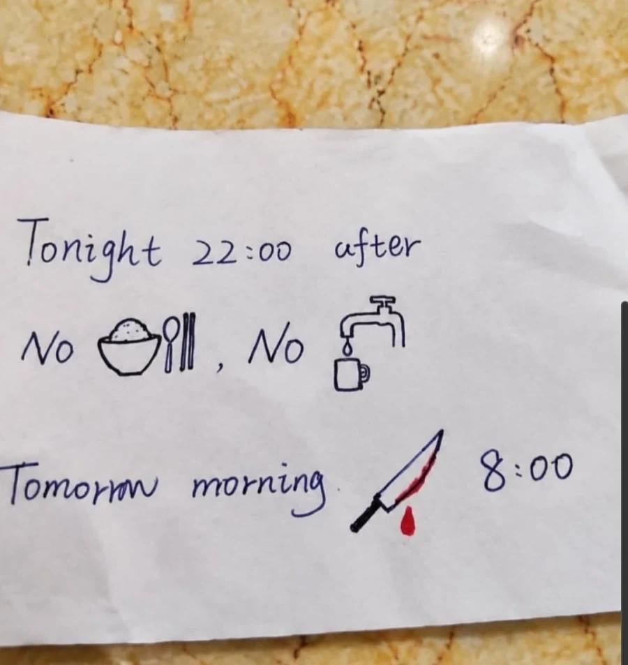수술하는 외국인도 알아볼수 있게 설명을 그려준 간호사