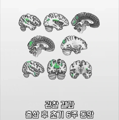 아빠가 되면 남자의 몸에도 변화가 생긴다는 연구.jpg - 이미지 18