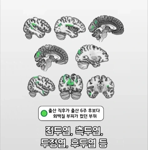 아빠가 되면 남자의 몸에도 변화가 생긴다는 연구.jpg - 이미지 19