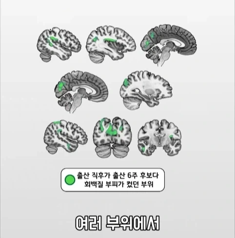 아빠가 되면 남자의 몸에도 변화가 생긴다는 연구.jpg - 이미지 20