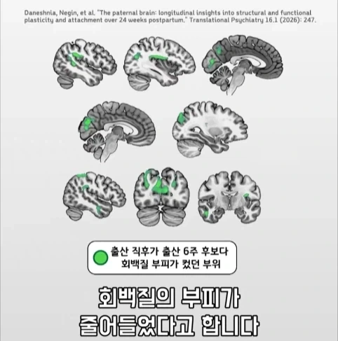 아빠가 되면 남자의 몸에도 변화가 생긴다는 연구.jpg - 이미지 21