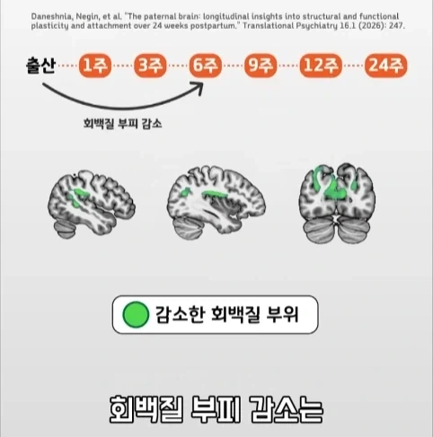 아빠가 되면 남자의 몸에도 변화가 생긴다는 연구.jpg - 이미지 26