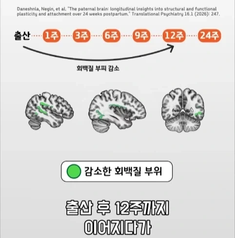 아빠가 되면 남자의 몸에도 변화가 생긴다는 연구.jpg - 이미지 27