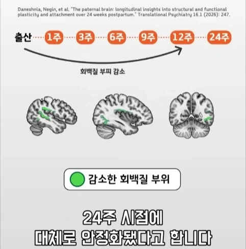 아빠가 되면 남자의 몸에도 변화가 생긴다는 연구.jpg - 이미지 28