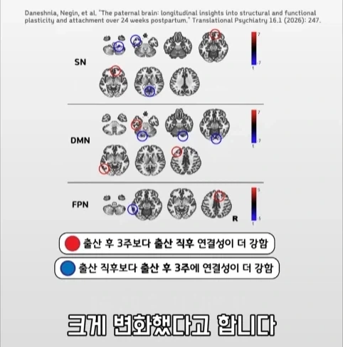 아빠가 되면 남자의 몸에도 변화가 생긴다는 연구.jpg - 이미지 31