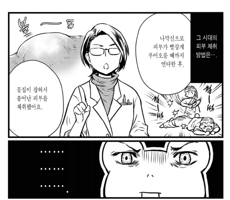 고대 린도의 피부이식수술 - 이미지 2