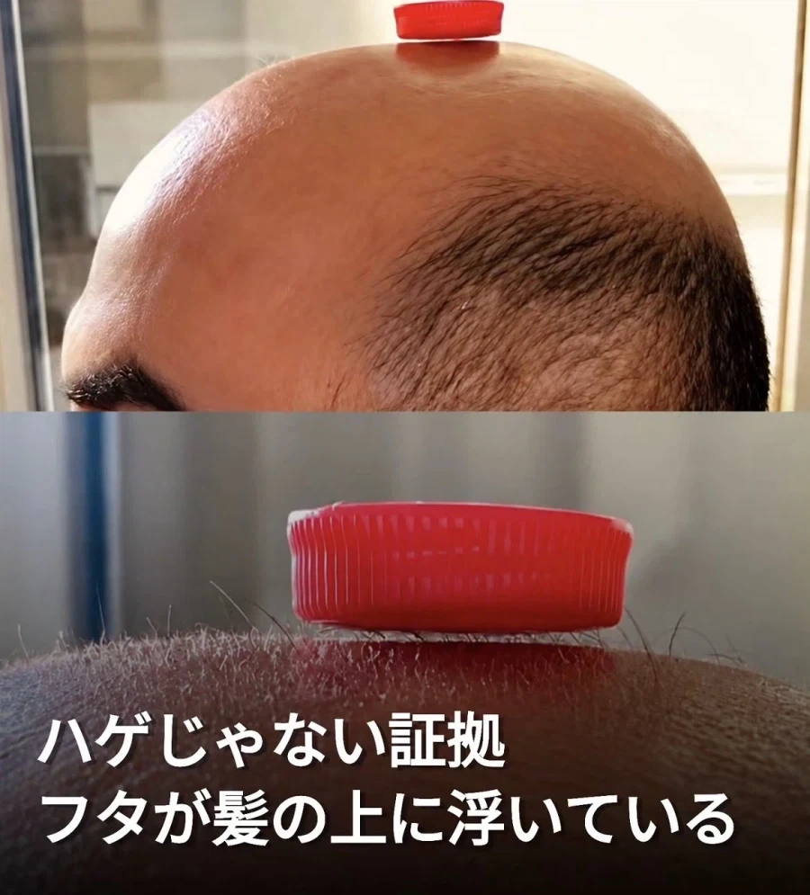 대머리가 아니라는 증거