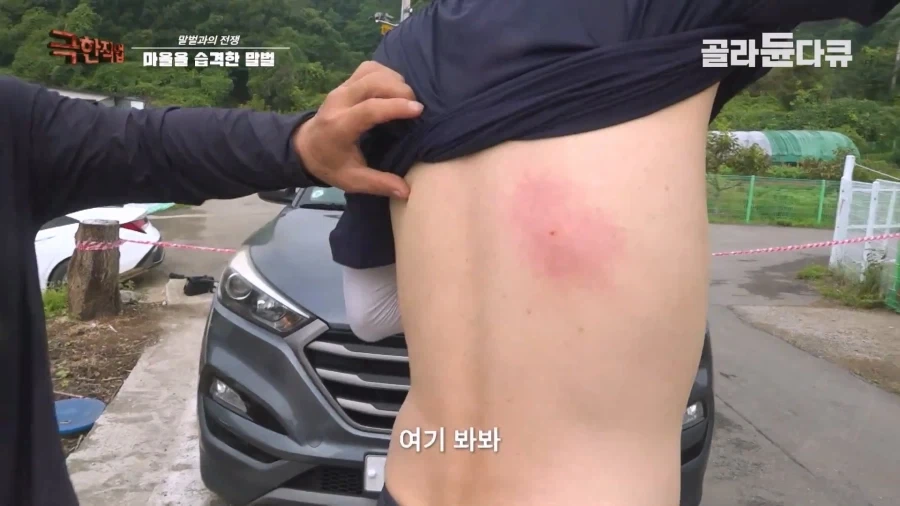 말벌에 강하다는 벌꾼이 장수말벌에 쏘였을 때 - 이미지 11