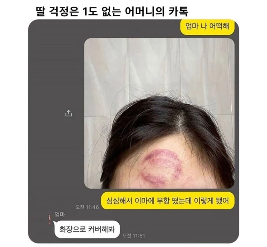 심심해서 이마에 장난쳤다가 엄마에게 해결책을 물어봤다