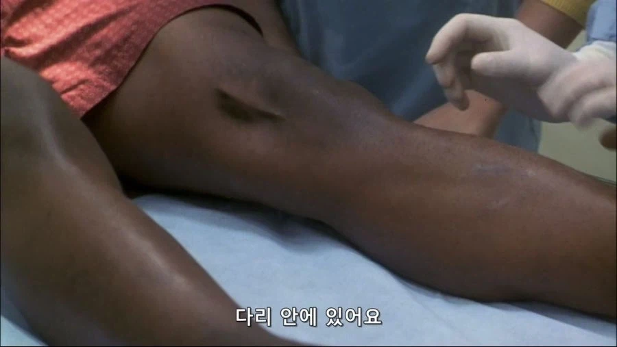 엉덩이속에 벌레간 들어간 남자 - 이미지 5
