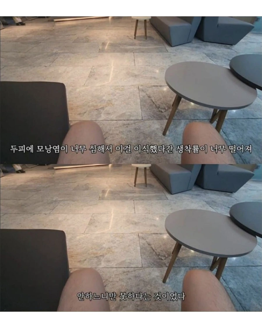 터키로 모발이식 받으러간 남자의 최후.jpg - 이미지 4