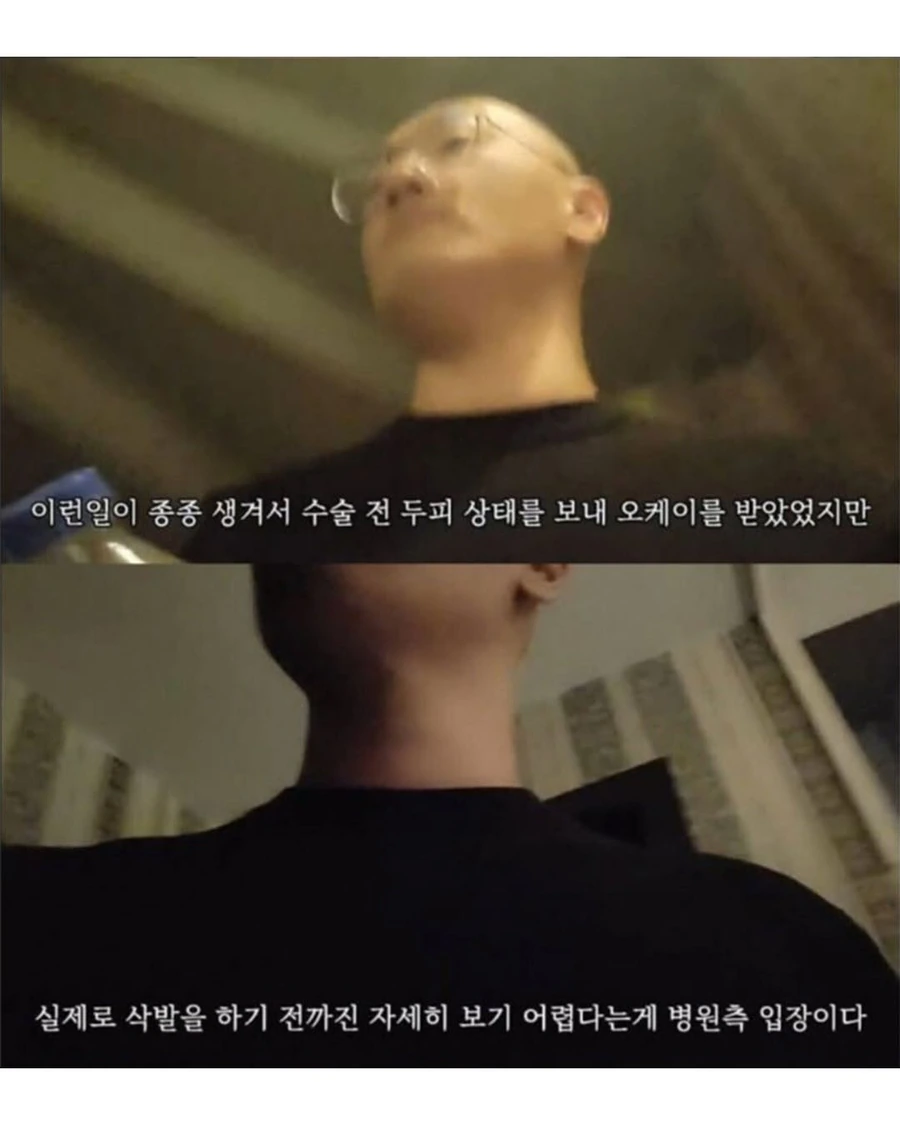 터키로 모발이식 받으러간 남자의 최후.jpg - 이미지 5