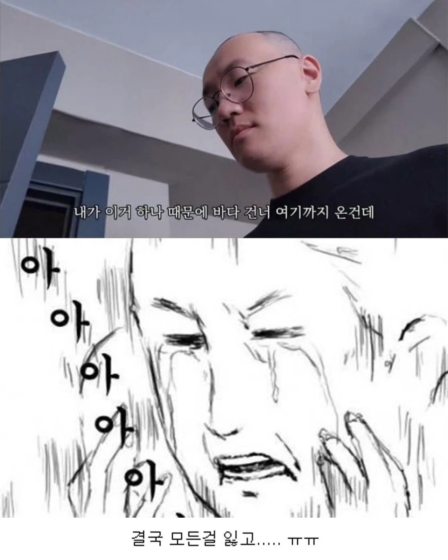 터키로 모발이식 받으러간 남자의 최후.jpg - 이미지 6
