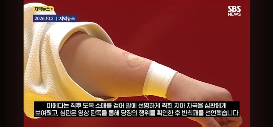 나고야)사람 무는 ㄱㅅㄲ를 키우는 나라 - 이미지 4