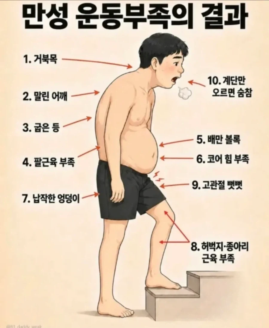 만성 운동 부족 남성의 몸.jpg