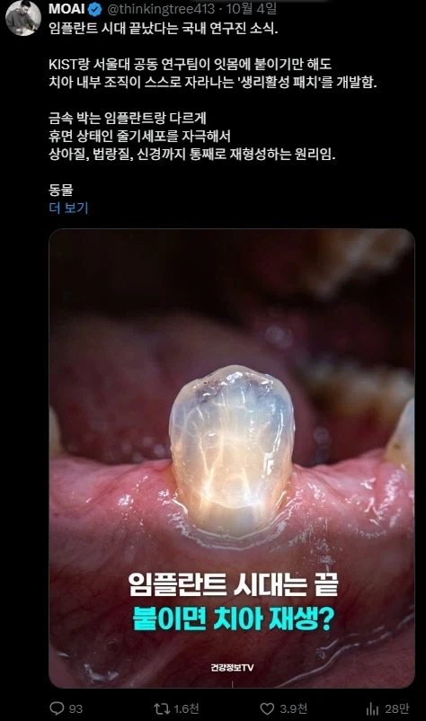 치아 임플란트를 대체하게 될 치아재생 기술이라는데