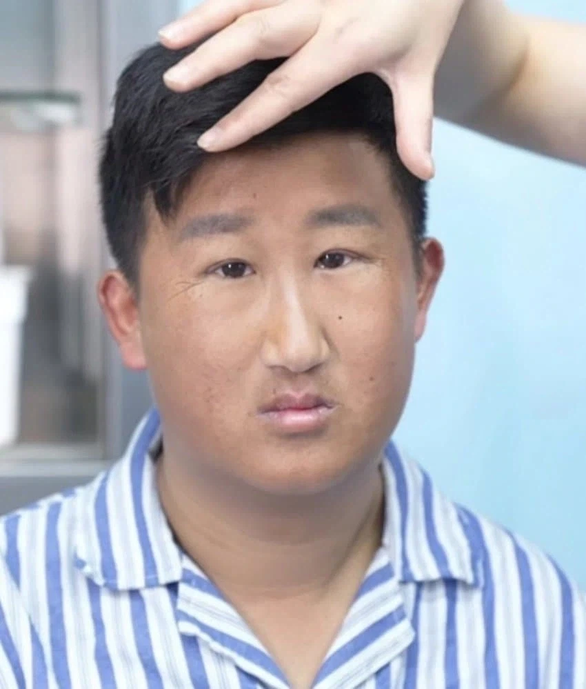 성형수술로 180도 바뀐 남자 - 이미지 2