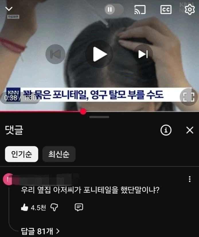 꽉 묶은 포니테일, 영구 탈모 부를 수도