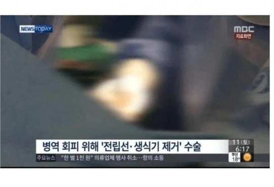 병역회피 레전드