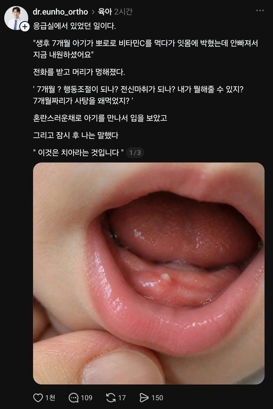 아기 잇몸에 사탕이 박혀 응급실에 간 사건 ㄷㄷㄷㄷㄷㄷㄷㄷㄷㄷㄷ