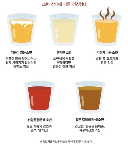 그림으로 보는 소변 상태