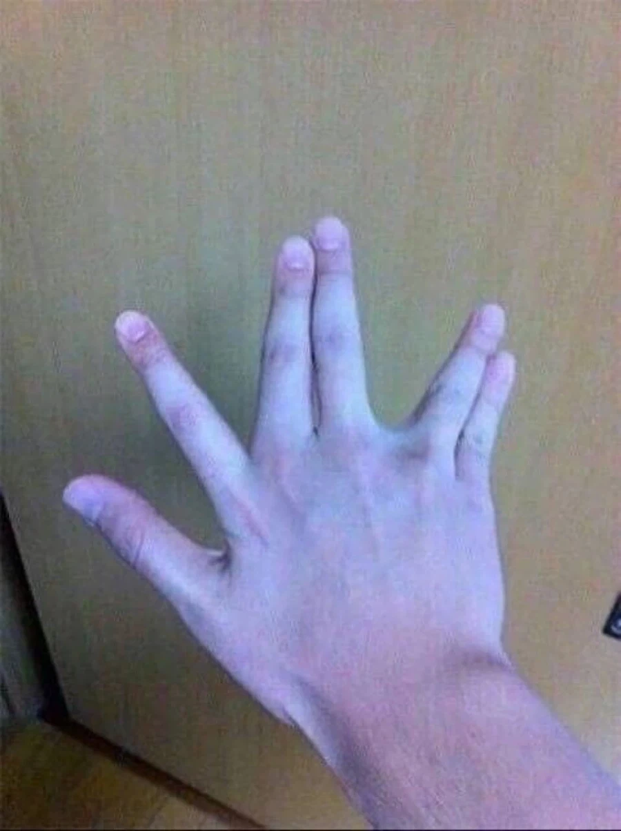이거 되는사람 있음?
