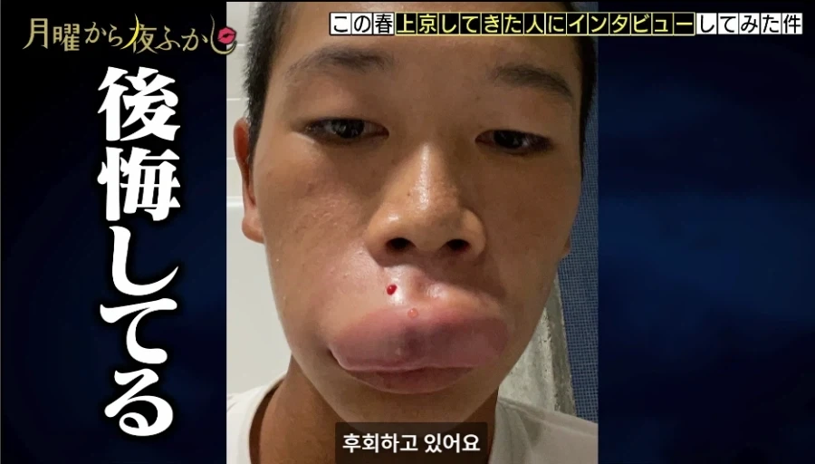도쿄 상경하자마자 바로 꽃뱀에게 제대로 물린 일본 시골 청년 ㅠㅠ - 이미지 8
