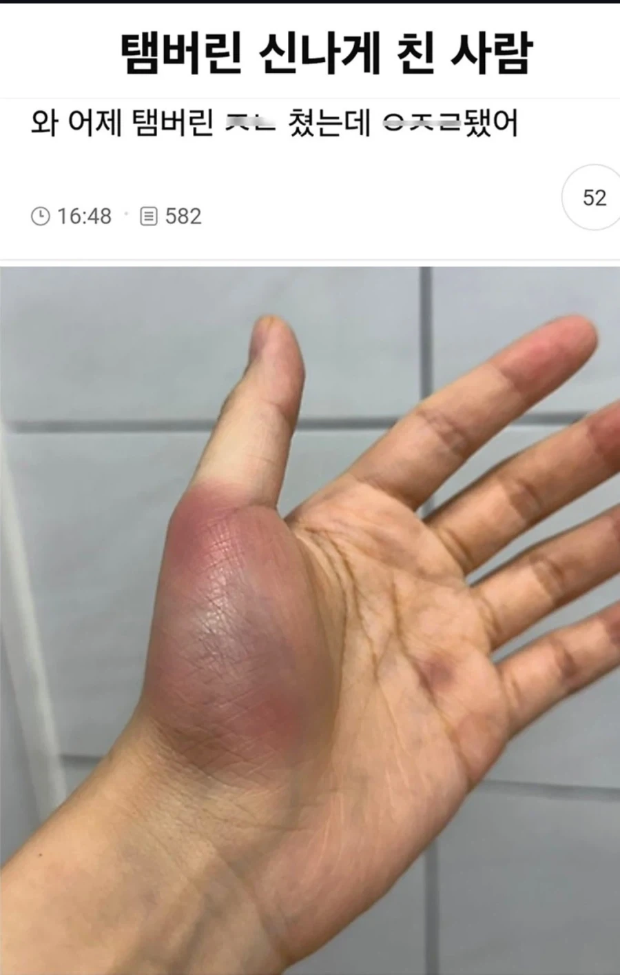 너무 신나게 논 대가