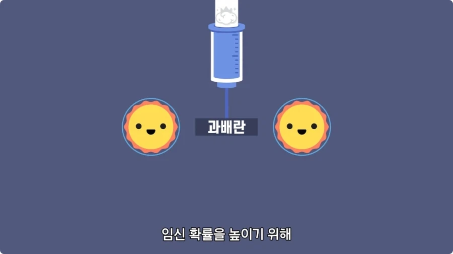 사람은 이론상 오십쌍둥이를 낳을 수 있다.jpg - 이미지 5