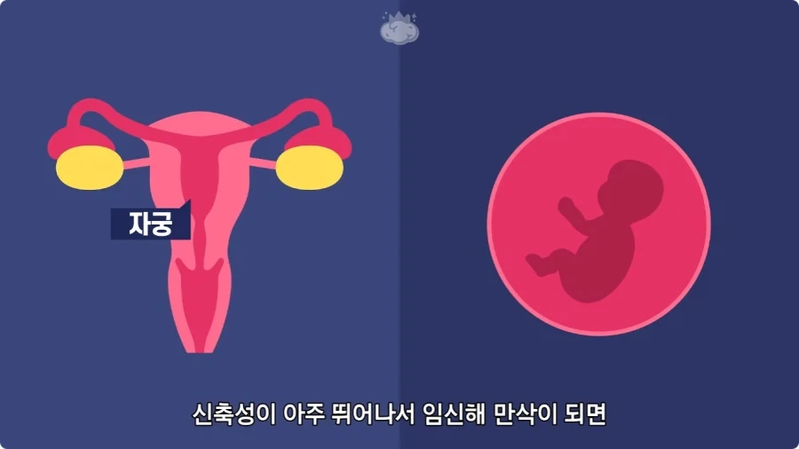 사람은 이론상 오십쌍둥이를 낳을 수 있다.jpg - 이미지 14