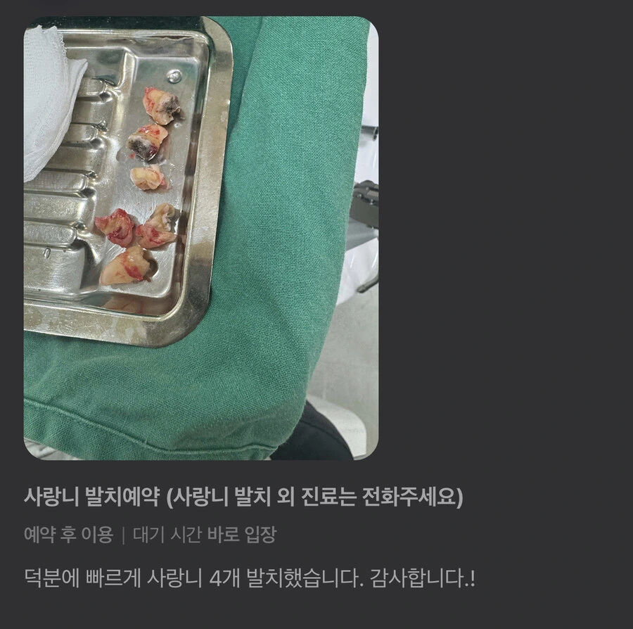 사랑니 전문 치과의 위엄 - 이미지 2