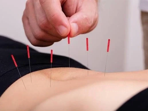 동서양 모두 침술에 대해 인정하는 특징