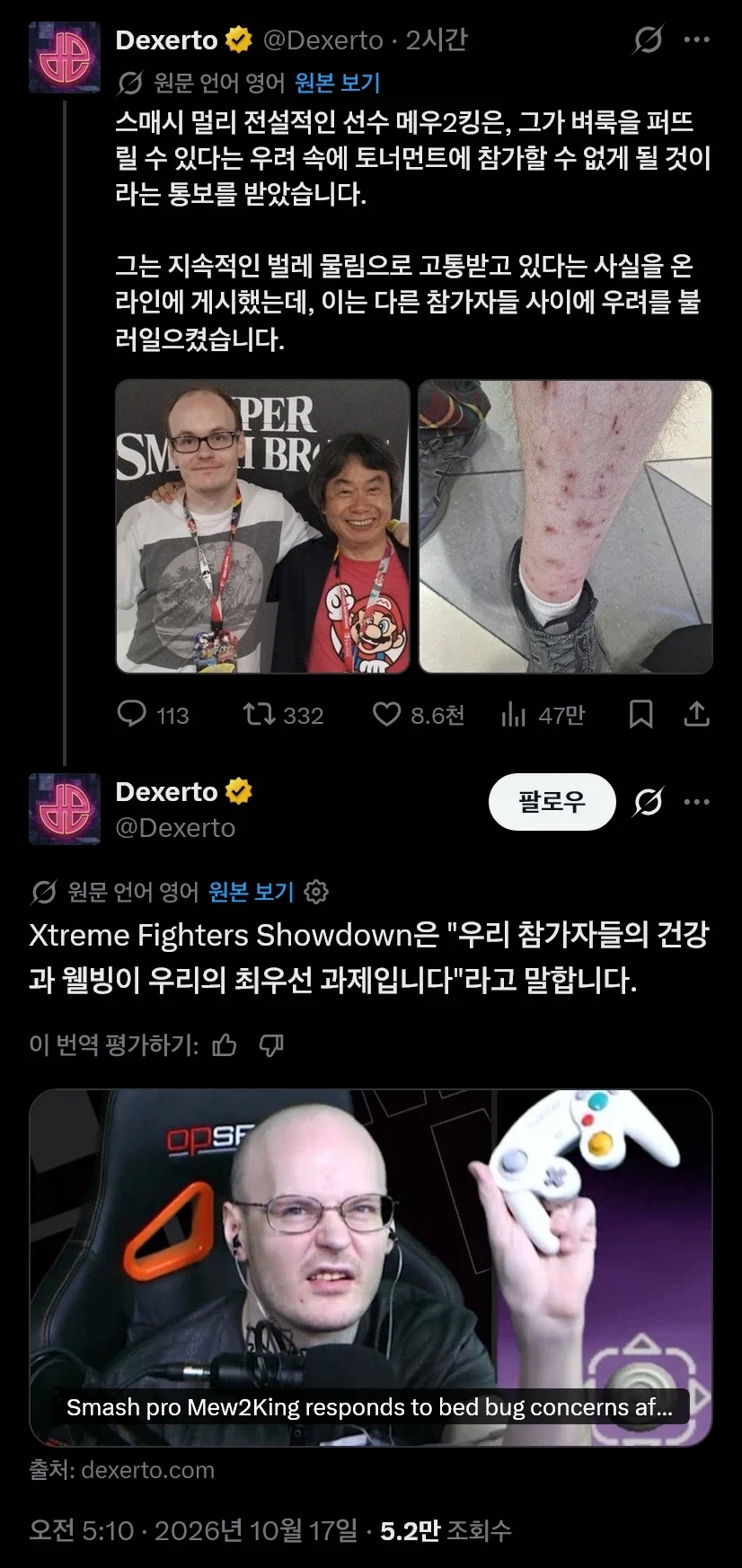 안씻는덕후 최종보스가 등장한 미국