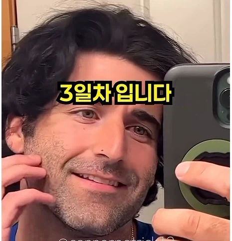 남자들이 은근 부러워 하는 털.jpg - 이미지 3