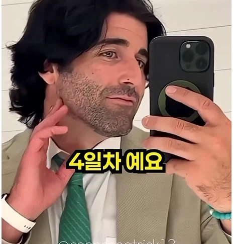 남자들이 은근 부러워 하는 털.jpg - 이미지 4