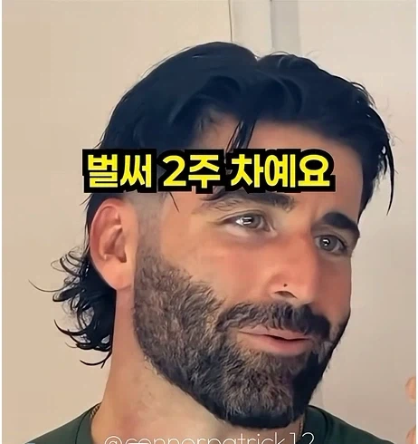 남자들이 은근 부러워 하는 털.jpg - 이미지 8