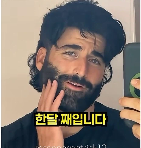 남자들이 은근 부러워 하는 털.jpg - 이미지 10